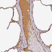 Anti-CFHR1 antibody produced in rabbit HPA038922-100UL