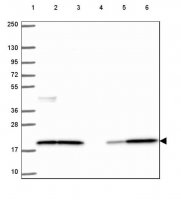 Anti-CFL1 antibody produced in rabbit 