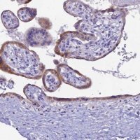 Anti-CGB3 antibody produced in rabbit 