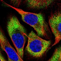 Anti-CHAC2 antibody produced in rabbit 