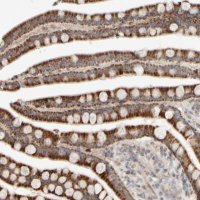 Anti-CHADL antibody produced in rabbit 