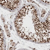 Anti-CHAF1B antibody produced in rabbit