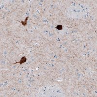 Anti-CHAT antibody produced in rabbit 