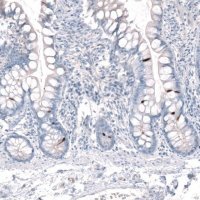 Anti-CHAT antibody produced in rabbit 