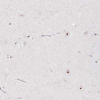 Anti-CHD2 antibody produced in rabbit 