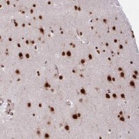 Anti-CHERP antibody produced in rabbit 