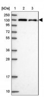 Anti-CHERP antibody produced in rabbit 