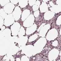 Anti-CHIT1 antibody produced in rabbit 