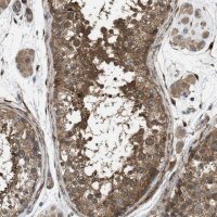Anti-CHKB antibody produced in rabbit 