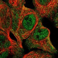 Anti-CHPF2 antibody produced in rabbit