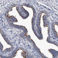 Anti-CHRNA3 antibody produced in rabbit 