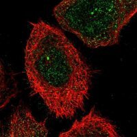 Anti-CHST15 antibody produced in rabbit