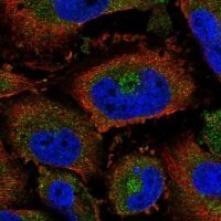 Anti-CHST3 antibody produced in rabbit 