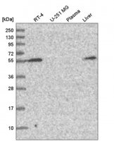 Anti-CHST3 antibody produced in rabbit 