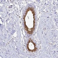 Anti-CIB1 antibody produced in rabbit 
