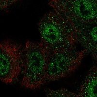Anti-CIC antibody produced in rabbit 