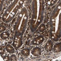 Anti-CIDEC antibody produced in rabbit 
