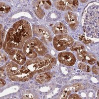 Anti-CILP2 antibody produced in rabbit 