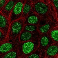 Anti-CIRBP antibody produced in rabbit 