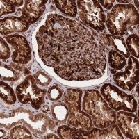 Anti-CISH antibody produced in rabbit 