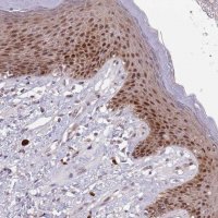 Anti-CIZ1 antibody produced in rabbit 