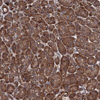 Anti-CKAP5 antibody produced in rabbit 