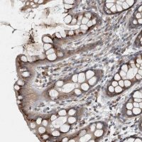 Anti-CLCN2 antibody produced in rabbit 