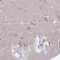 Anti-CLCN3 antibody produced in rabbit 