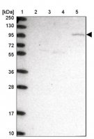 Anti-CLCN3 antibody produced in rabbit 