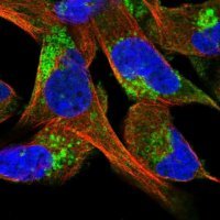 Anti-CLCN5 antibody produced in rabbit 