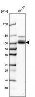 Anti-CLCN5 antibody produced in rabbit 