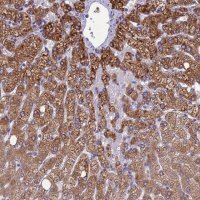 Anti-CLCN7 antibody produced in rabbit 