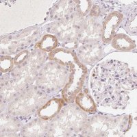 Anti-CLCNKA antibody produced in rabbit 