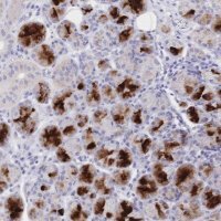 Anti-CLEC18B antibody produced in rabbit 
