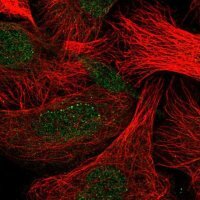 Anti-CLEC7A antibody produced in rabbit HPA050229-100UL