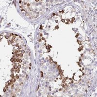 Anti-CLGN antibody produced in rabbit 