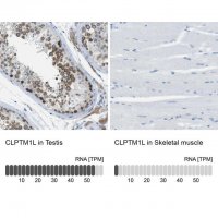 Anti-CLPTM1L antibody produced in rabbit 