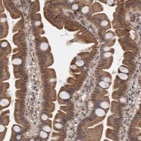 Anti-CMPK2 antibody produced in rabbit 