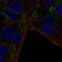 Anti-CMTM7 antibody produced in rabbit 