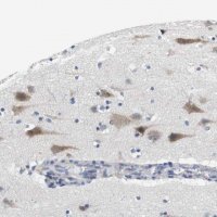 Anti-CNGA2 antibody produced in rabbit 