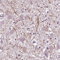 Anti-CNGA3 antibody produced in rabbit 