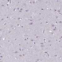 Anti-CNGB3 antibody produced in rabbit 
