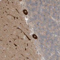 Anti-CNKSR1 antibody produced in rabbit 