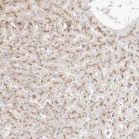 Anti-CNMD antibody produced in rabbit 