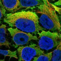 Anti-CNN2 antibody produced in rabbit 