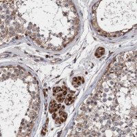 Anti-CNNM1 antibody produced in rabbit 