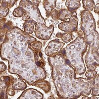 Anti-CNOT1 antibody produced in rabbit 