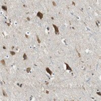 Anti-CNOT3 antibody produced in rabbit HPA006408-100UL
