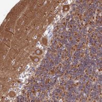 Anti-CNOT6 antibody produced in rabbit 