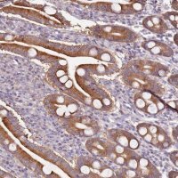 Anti-CNOT9 antibody produced in rabbit 